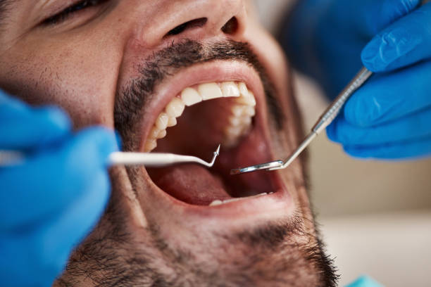 Best Dental Inlays and Onlays  in Fairmont, IL